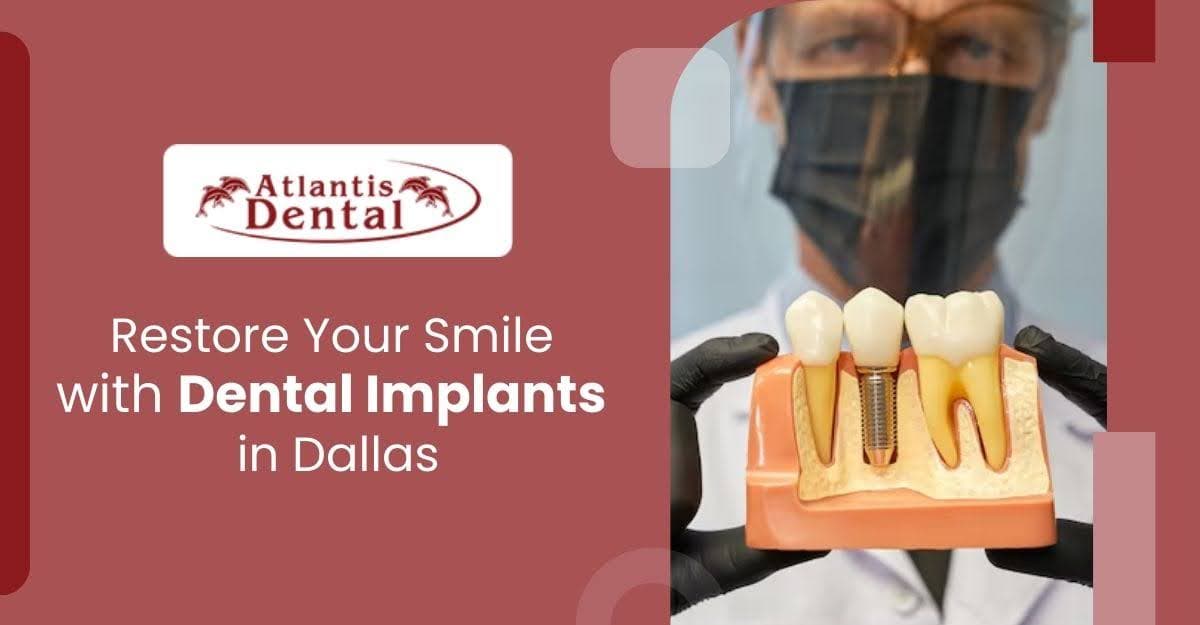 Restore Your Smile with Dental Implants in Dallas