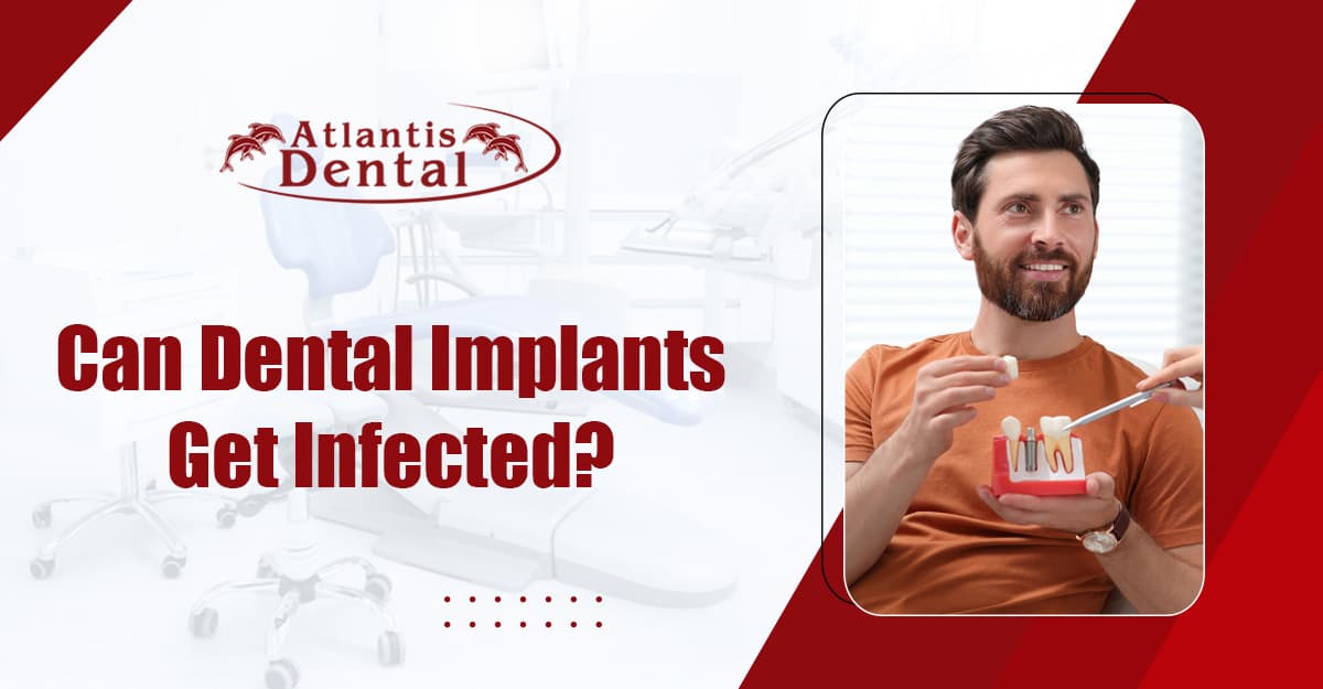 Can Dental Implants Get Infected? Understanding the Risks and How to Prevent Them