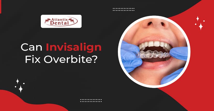 Can Invisalign Fix Overbite? | Atlantis Dental Blog