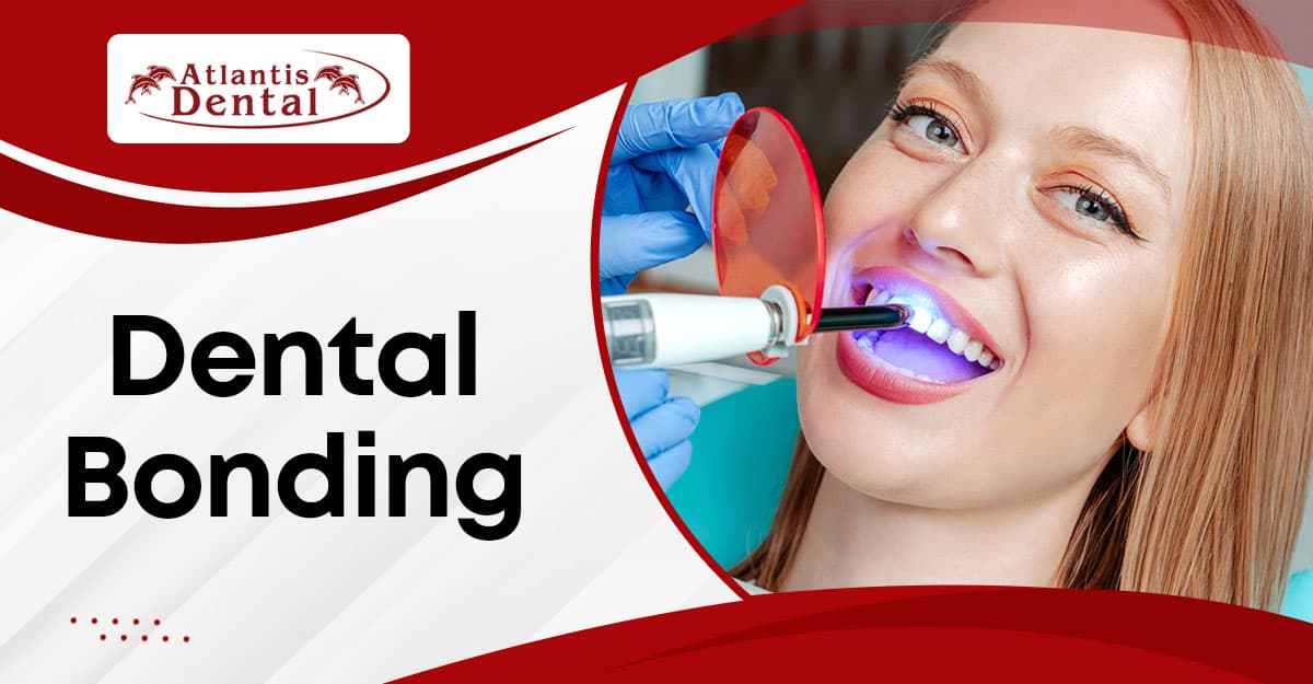 Dental Bonding: What You Need to Know