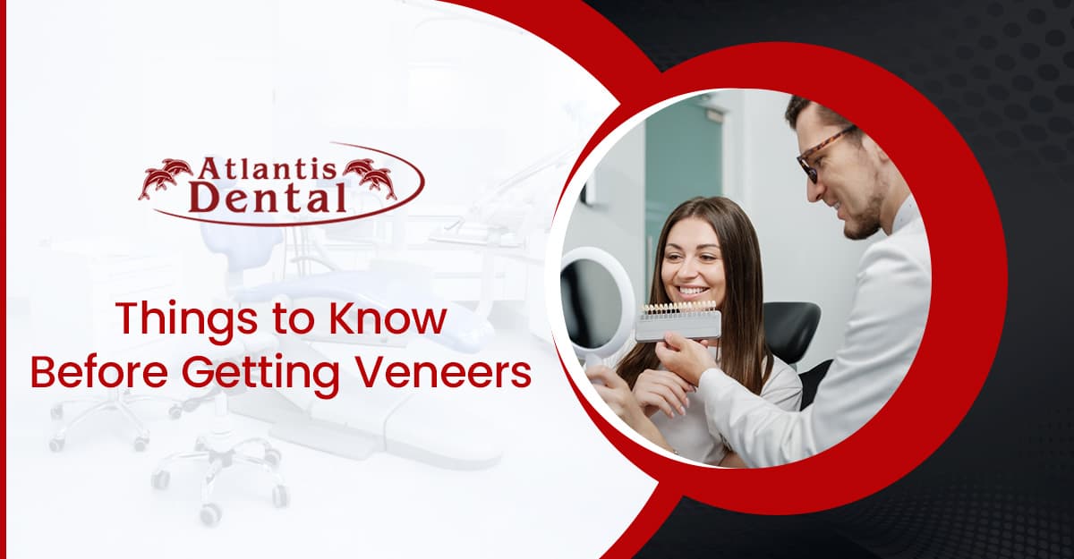 Everything You Need to Know Before Getting Veneers
