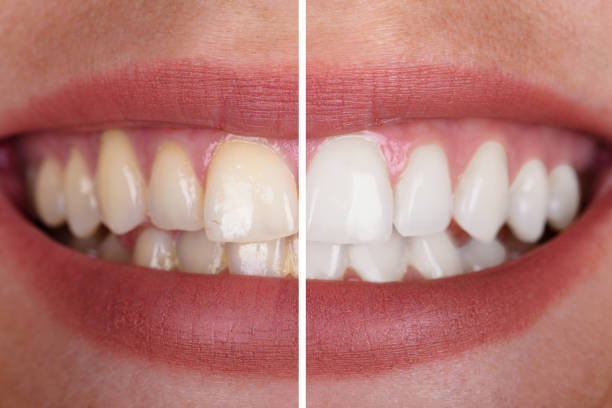 Teeth