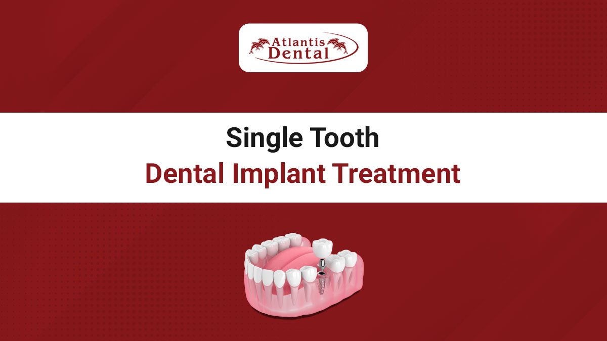 Dental Blogs - Atlantis Dental, Dallas, TX