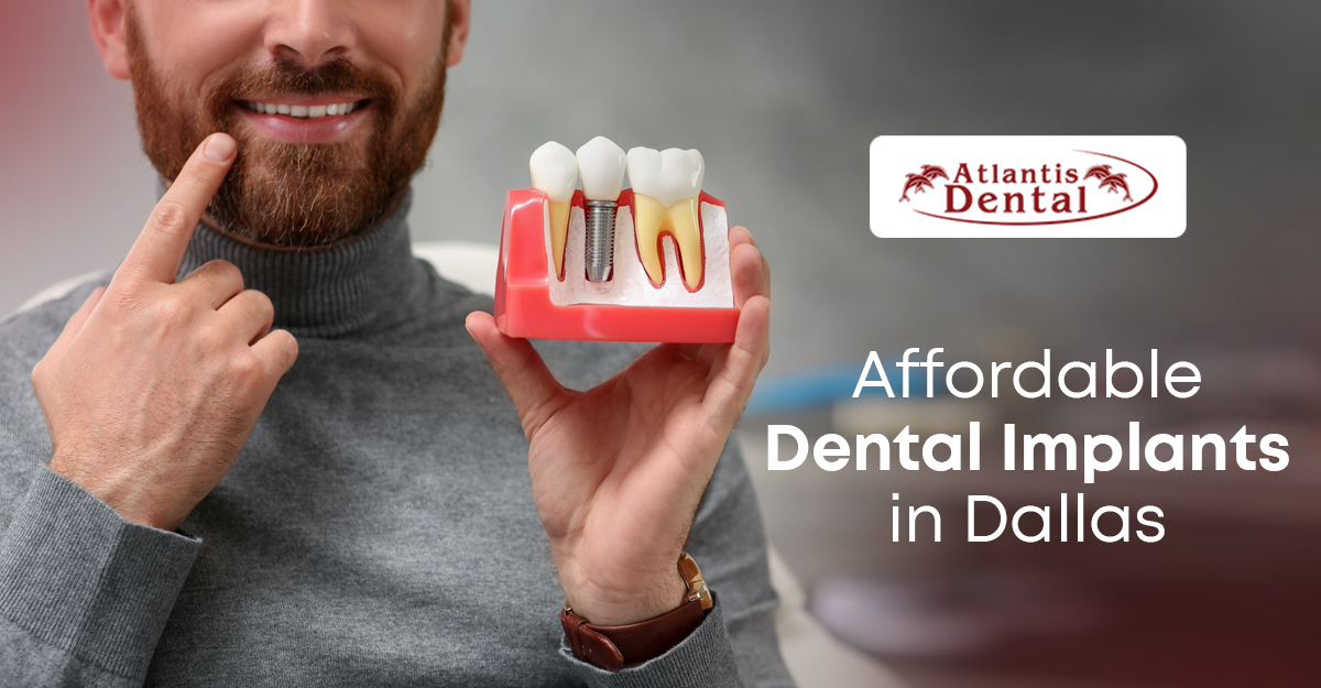 Affordable Dental Implants in Dallas, Texas