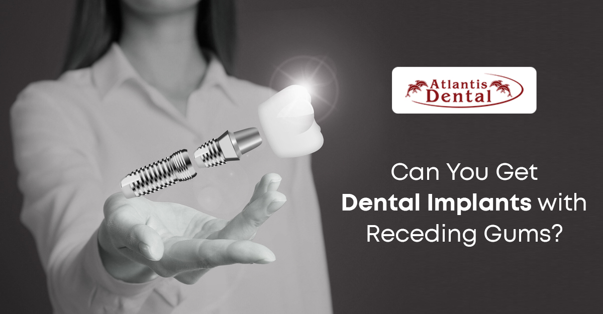 Can You Get Dental Implants with Receding Gums? - Consult Atlantis Dental in Dallas