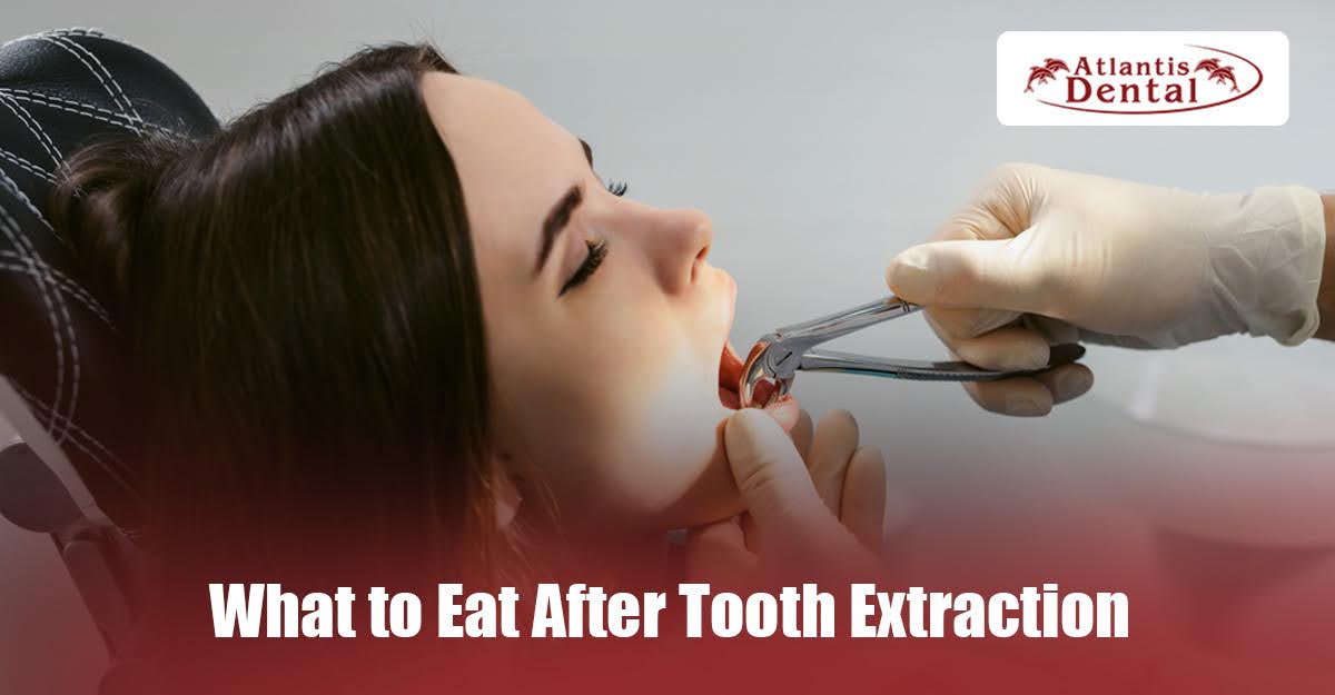 What to Eat After Tooth Extraction: A Comprehensive Recovery Guide